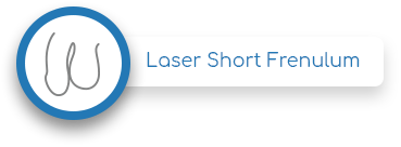 Laser short Frenulum
