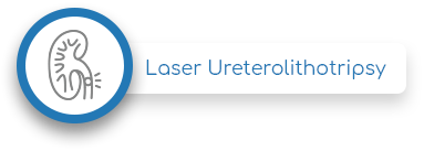 Laser ureterolithotripsy