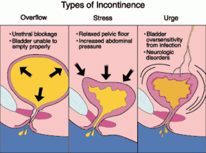 incontinence